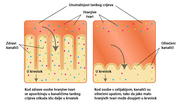 Gluten